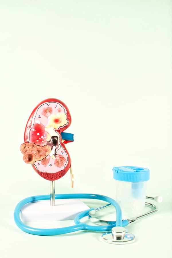 Servicio de urología para Próstata en Bogotá